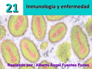 Inmunología y enfermedadInmunología y enfermedad
2121
Realizado por : Alberto Ángel Fuentes FunesRealizado por : Alberto Ángel Fuentes Funes
 