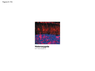 Figure 21.17d
Heterozygote
 