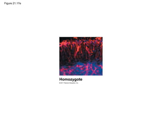 Figure 21.17e
Homozygote
 