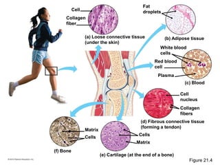 (a) Loose connective tissue
(under the skin)
(b) Adipose tissue
(c) Blood
(d) Fibrous connective tissue
(forming a tendon)
(e) Cartilage (at the end of a bone)
(f) Bone
Cell
Cells
Matrix
Plasma
Matrix
Cells
Collagen
fiber
Fat
droplets
White blood
cells
Red blood
cell
Cell
nucleus
Collagen
fibers
Figure 21.4
 