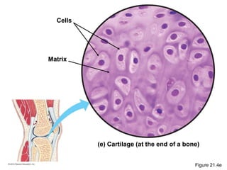 (e) Cartilage (at the end of a bone)
Matrix
Cells
Figure 21.4e
 