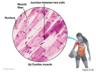 (b) Cardiac muscle
Muscle
fiber
Junction between two cells
Nucleus
Figure 21.5b
 
