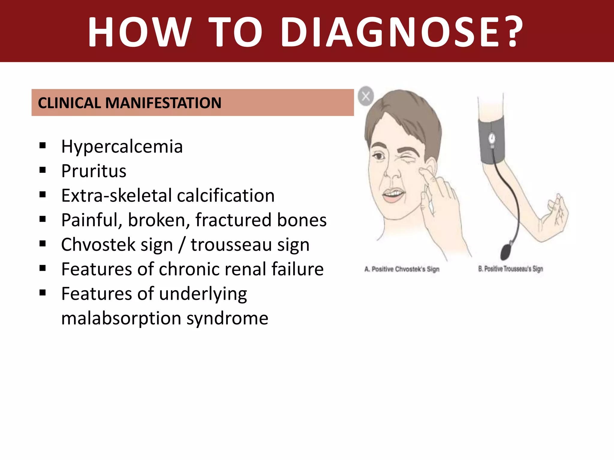 HOW TO DIAGNOSE?
 Hypercalcemia
 Pruritus
 Extra-skeletal calcification
 Painful, broken, fractured bones
 Chvostek sign / trousseau sign
 Features of chronic renal failure
 Features of underlying
malabsorption syndrome
CLINICAL MANIFESTATION
 
