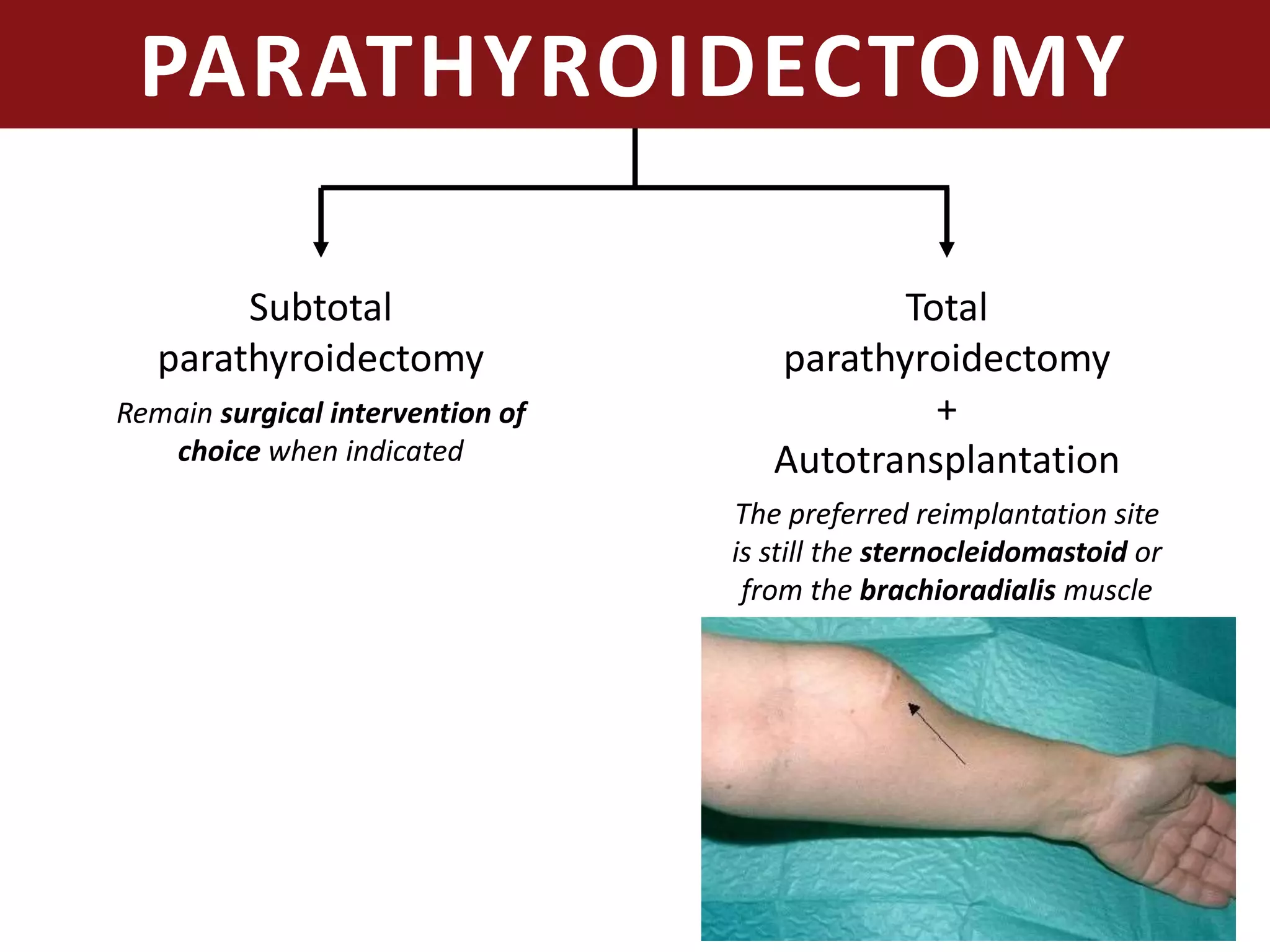 PARATHYROIDECTOMY
Subtotal
parathyroidectomy
Total
parathyroidectomy
+
Autotransplantation
Remain surgical intervention of
choice when indicated
The preferred reimplantation site
is still the sternocleidomastoid or
from the brachioradialis muscle
 