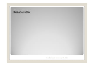 thenar atrophy




                 Maria Carmela L. Domocmat, RN, MSN
 