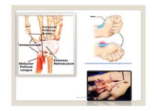 Maria Carmela L. Domocmat, RN, MSN
 