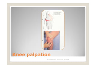 Knee palpation
            Maria Carmela L. Domocmat, RN, MSN
 