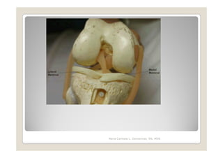 http://www.marvistavet.com/assets/i
mages/knee_meniscus_model.gif




                Maria Carmela L. Domocmat, RN, MSN
 
