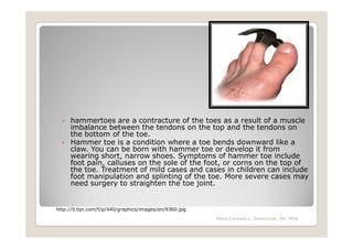 hammertoes are a contracture of the toes as a result of a muscle
     imbalance between the tendons on the top and the tendons on
     the bottom of the toe.
     Hammer toe is a condition where a toe bends downward like a
     claw. You can be born with hammer toe or develop it from
     wearing short, narrow shoes. Symptoms of hammer toe include
     foot pain, calluses on the sole of the foot, or corns on the top of
     the toe. Treatment of mild cases and cases in children can include
     foot manipulation and splinting of the toe. More severe cases may
     need surgery to straighten the toe joint.


http://0.tqn.com/f/p/440/graphics/images/en/9360.jpg
                                                       Maria Carmela L. Domocmat, RN, MSN
 