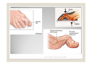 Maria Carmela L. Domocmat, RN, MSN
 
