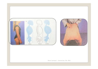 Maria Carmela L. Domocmat, RN, MSN
 