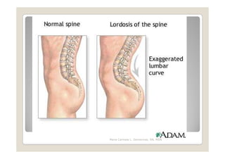 Maria Carmela L. Domocmat, RN, MSN
 