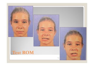 Test ROM
           Maria Carmela L. Domocmat, RN, MSN
 