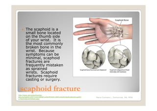 The scaphoid is a
         small bone located
         on the thumb side
         of your wrist. It is
         the most commonly
         broken bone in the
         wrist. Because
         symptoms can be
         minimal, scaphoid
         fractures are
         frequently mistaken
         as sprained
         wrists. Scaphoid
         fractures require
         casting or surgery.

  scaphoid fracture
http://www.vermontorthoclinic-
edu.org/tabid/14407/mid/24836/ContentPubID/108/ContentClassificationGroupID/-   Maria Carmela L. Domocmat, RN, MSN
1/ViewIndex/0/Default.aspx
 
