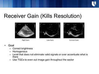 Receiver Gain (Kills Resolution)
• Goal
– Correct brightness
– Homogenous
– Level that does not eliminate valid signals or over accentuate what is
there
– Use TGCs to even out image gain throughout the sector
High Gain Low Gain Correct Gain
 