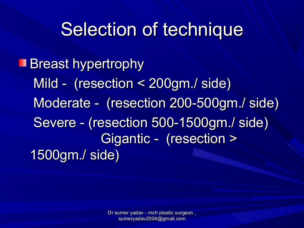 reduction mammoplasty