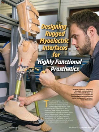 MEDICAL ROBOTICS SPECIAL REPORT
2 SEPTEMBER 2021
Designing
Rugged
Myoelectric
Interfaces
for
Highly Functional
Prosthetics
T
o use the laptops and
cellphones in today’s world,
modern prosthetic devices
connect signals from the brain
via surface-mounted sensors and
detectors. New sensor technologies
combined with high-performance micro-
wiring is extending the performance
and reliability of active myoelectric
prosthetics. The evolution of newly
developed microprocessor chip sensors
offers advanced communication
Implanted transducers that provide
kinesthetic communications of
force and vibration feedback are
particularly helpful in full leg and arm
prosthetics where activating multiple
muscles simultaneously is necessary.
(Credit: AdobeStock)
 