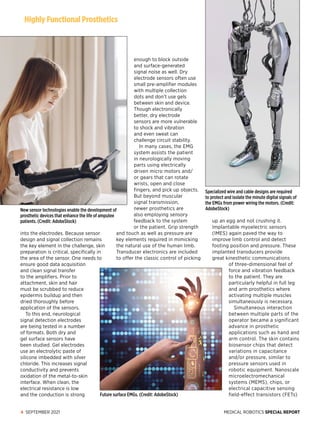 MEDICAL ROBOTICS SPECIAL REPORT
4 SEPTEMBER 2021
into the electrodes. Because sensor
design and signal collection remains
the key element in the challenge, skin
preparation is critical, specifically in
the area of the sensor. One needs to
ensure good data acquisition
and clean signal transfer
to the amplifiers. Prior to
attachment, skin and hair
must be scrubbed to reduce
epidermis buildup and then
dried thoroughly before
application of the sensors.
To this end, neurological
signal detection electrodes
are being tested in a number
of formats. Both dry and
gel surface sensors have
been studied. Gel electrodes
use an electrolytic paste of
silicone imbedded with silver
chloride. This increases signal
conductivity and prevents
oxidation of the metal-to-skin
interface. When clean, the
electrical resistance is low
and the conduction is strong
enough to block outside
and ­surface-­generated
signal noise as well. Dry
electrode sensors often use
small pre-amplifier modules
with multiple collection
dots and don’t use gels
between skin and device.
Though electronically
better, dry electrode
sensors are more vulnerable
to shock and vibration
and even sweat can
challenge circuit stability.
In many cases, the EMG
system assists the patient
in neurologically moving
parts using electrically
driven micro motors and/
or gears that can rotate
wrists, open and close
fingers, and pick up objects.
But beyond muscular
signal transmission,
newer prosthetics are
also employing sensory
feedback to the system
or the patient. Grip strength
and touch as well as pressure are
key elements required in mimicking
the natural use of the human limb.
Transducer electronics are included
to offer the classic control of picking
up an egg and not crushing it.
Implantable myoelectric sensors
(IMES) again paved the way to
improve limb control and detect
footing position and pressure. These
implanted transducers provide
great kinesthetic communications
of three-dimensional feel of
force and vibration feedback
to the patient. They are
particularly helpful in full leg
and arm prosthetics where
activating multiple muscles
simultaneously is necessary.
Simultaneous interaction
between multiple parts of the
operator became a significant
advance in prosthetic
applications such as hand and
arm control. The skin contains
biosensor chips that detect
variations in capacitance
and/or pressure, similar to
pressure sensors used in
robotic equipment. Nanoscale
microelectromechanical
systems (MEMS), chips, or
electrical capacitive sensing
field-effect transistors (FETs)
New sensor technologies enable the development of
prosthetic devices that enhance the life of amputee
patients. (Credit: AdobeStock)
Highly Functional Prosthetics
Future surface EMGs. (Credit: AdobeStock)
Specialized wire and cable designs are required
to protect and isolate the minute digital signals of
the EMGs from power wiring the motors. (Credit:
AdobeStock)
 