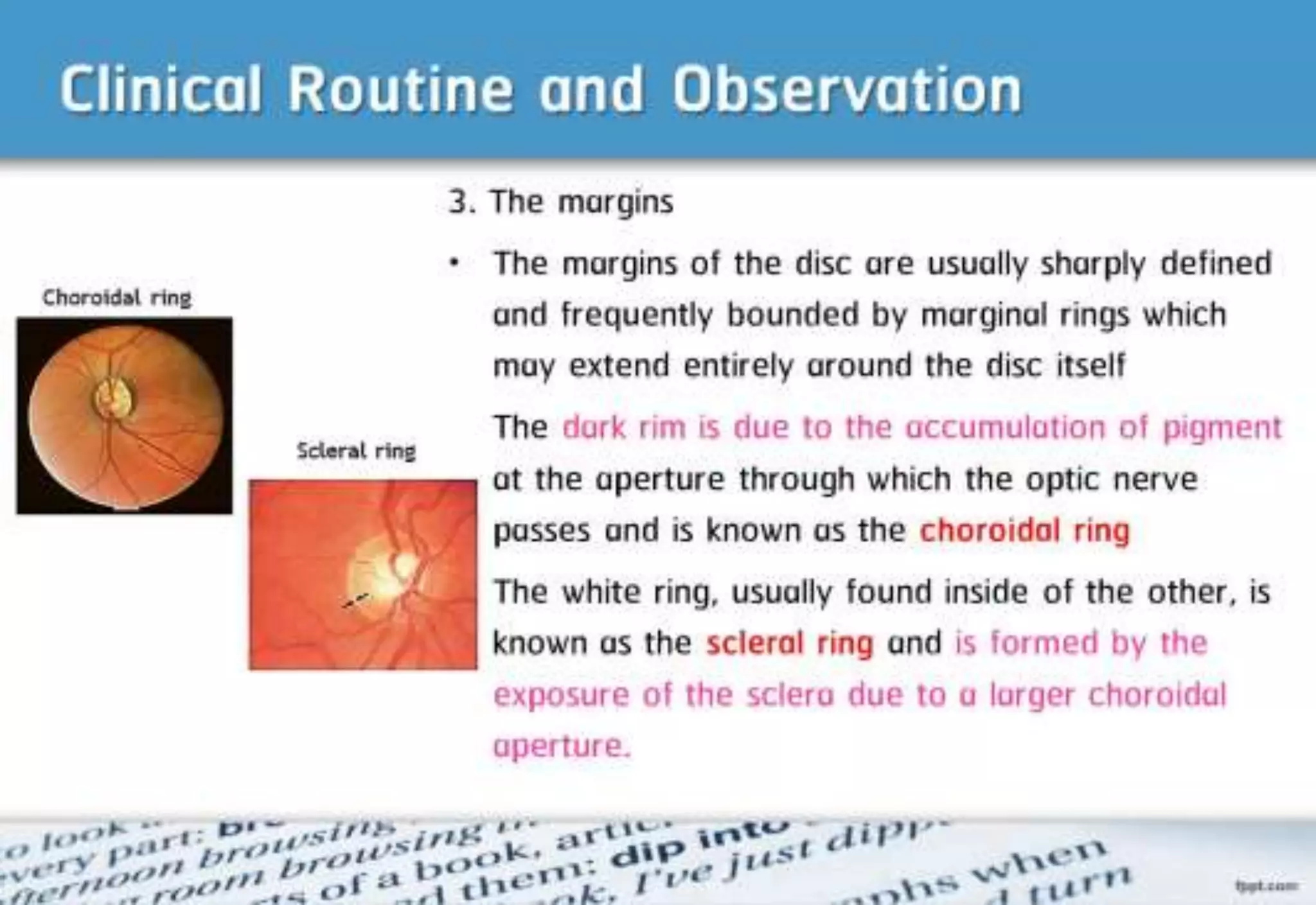21 step-Diagnosis Procedure Refraction