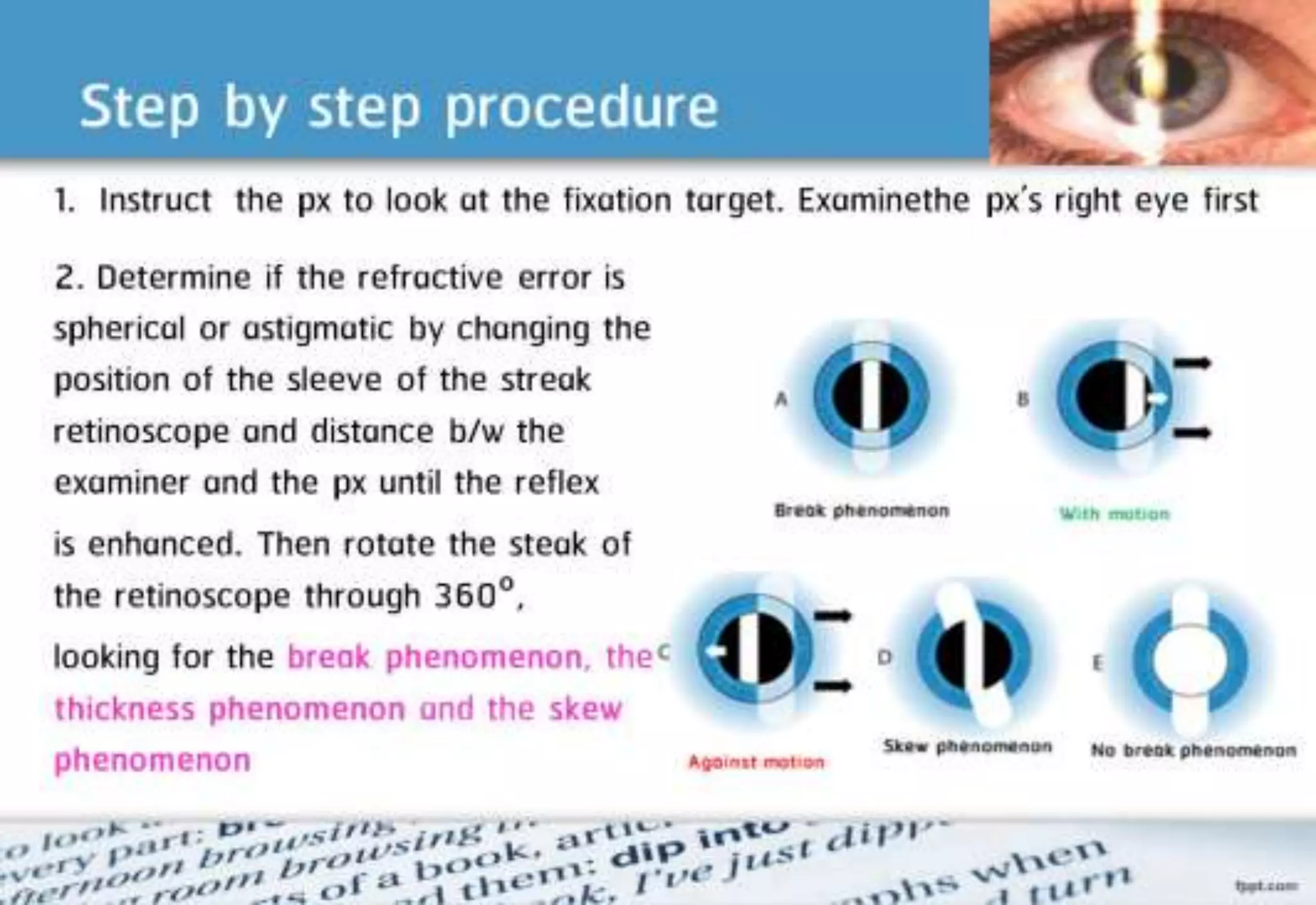 21 step-Diagnosis Procedure Refraction