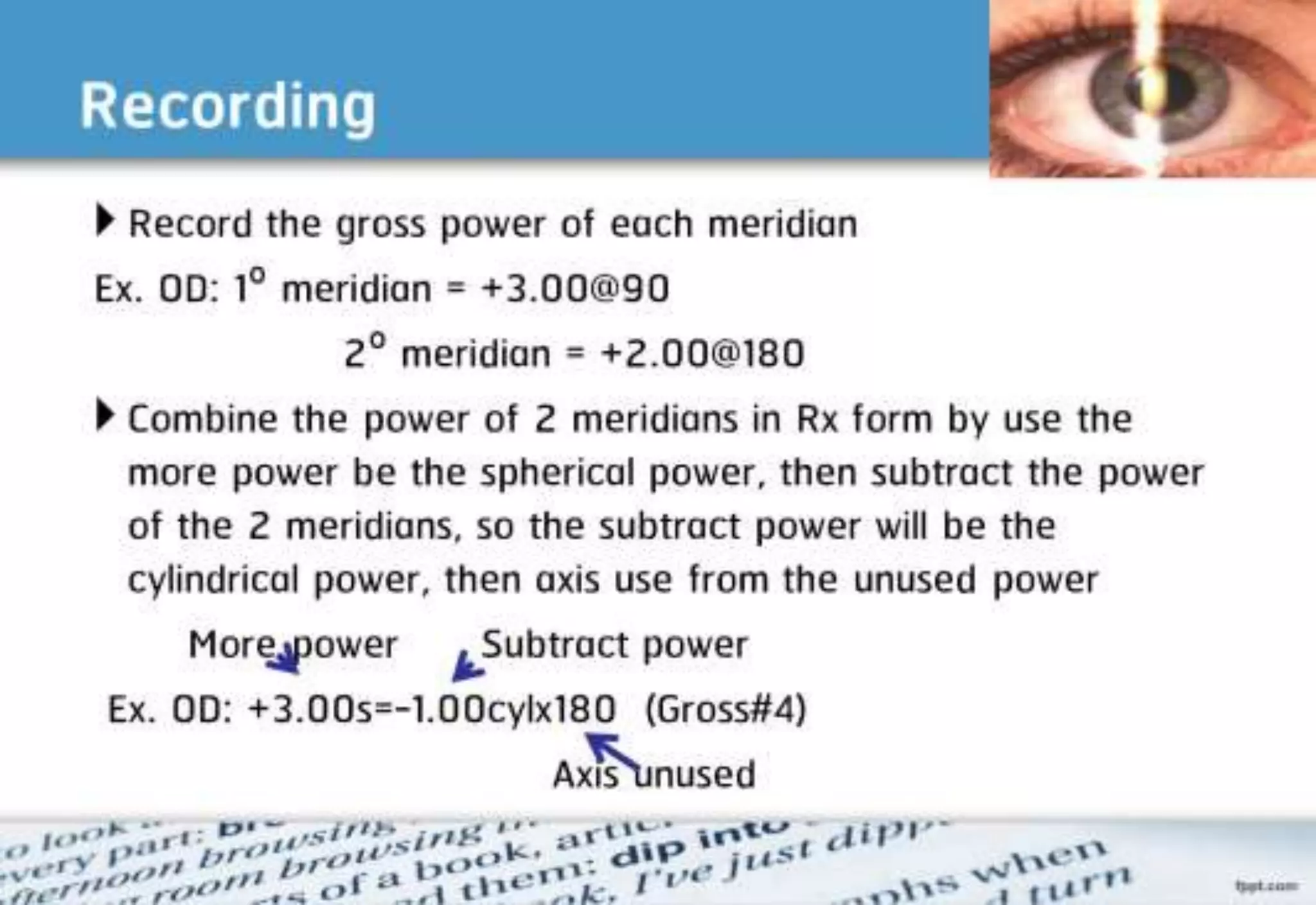 21 step-Diagnosis Procedure Refraction