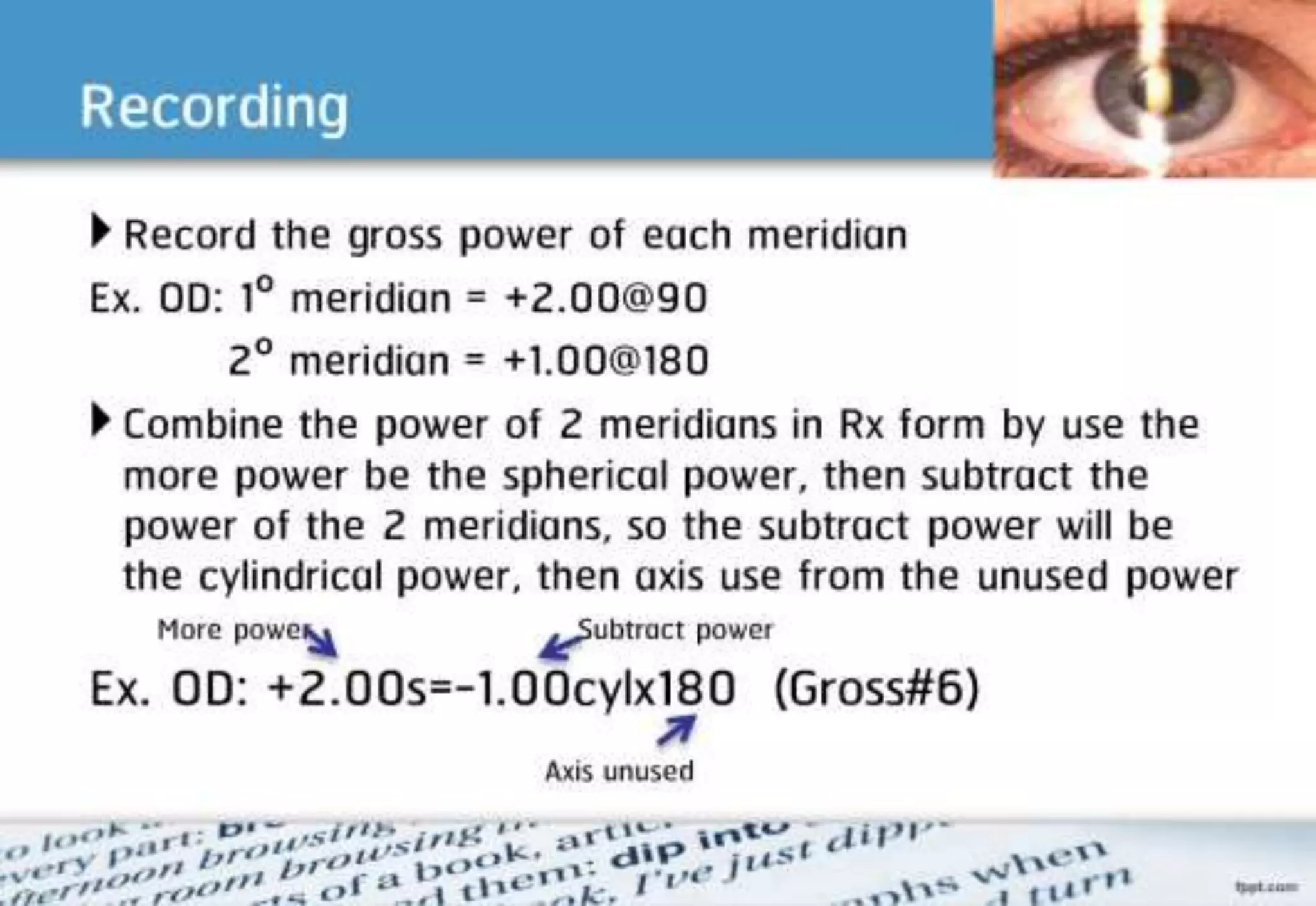 21 step-Diagnosis Procedure Refraction