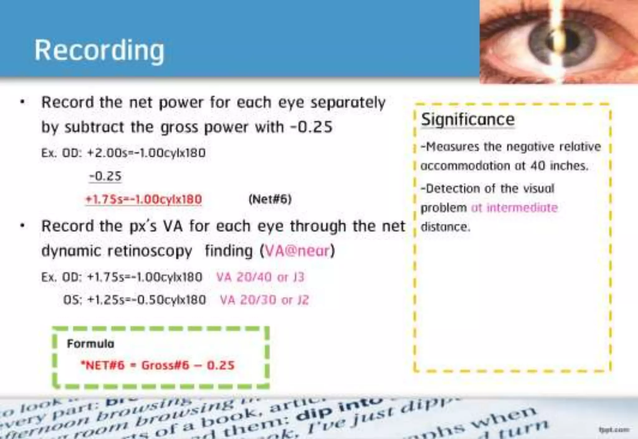 21 step-Diagnosis Procedure Refraction