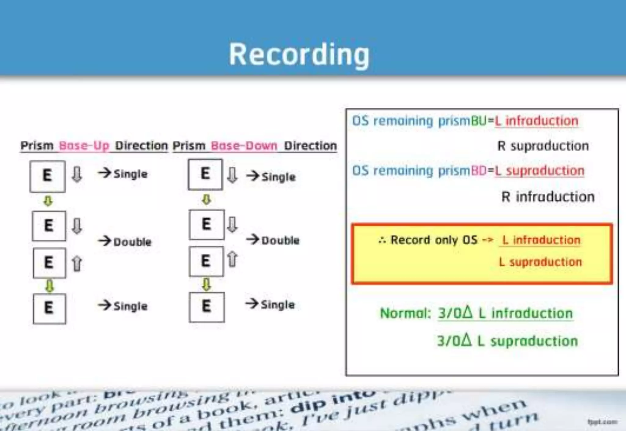 21 step-Diagnosis Procedure Refraction
