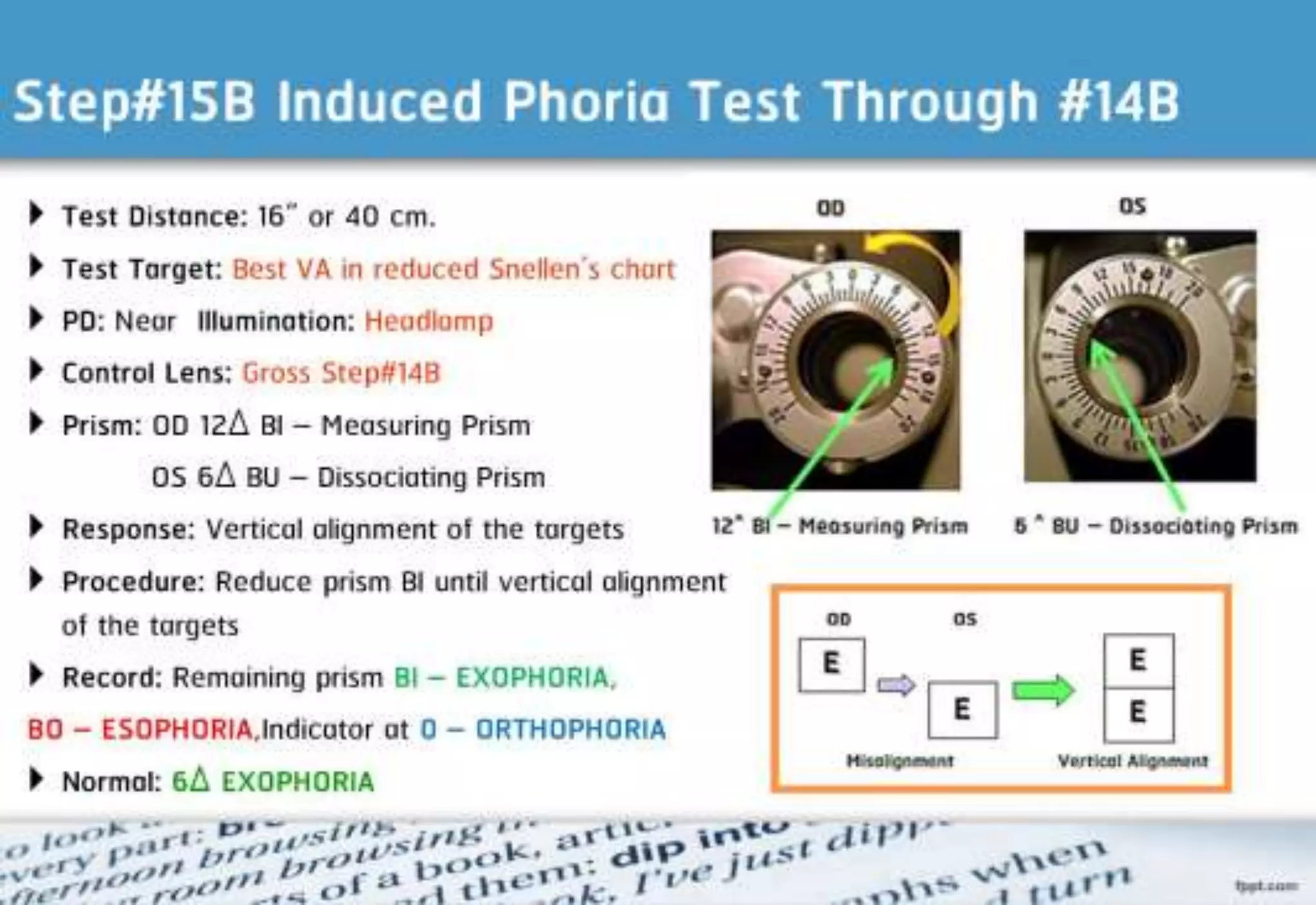 21 step-Diagnosis Procedure Refraction
