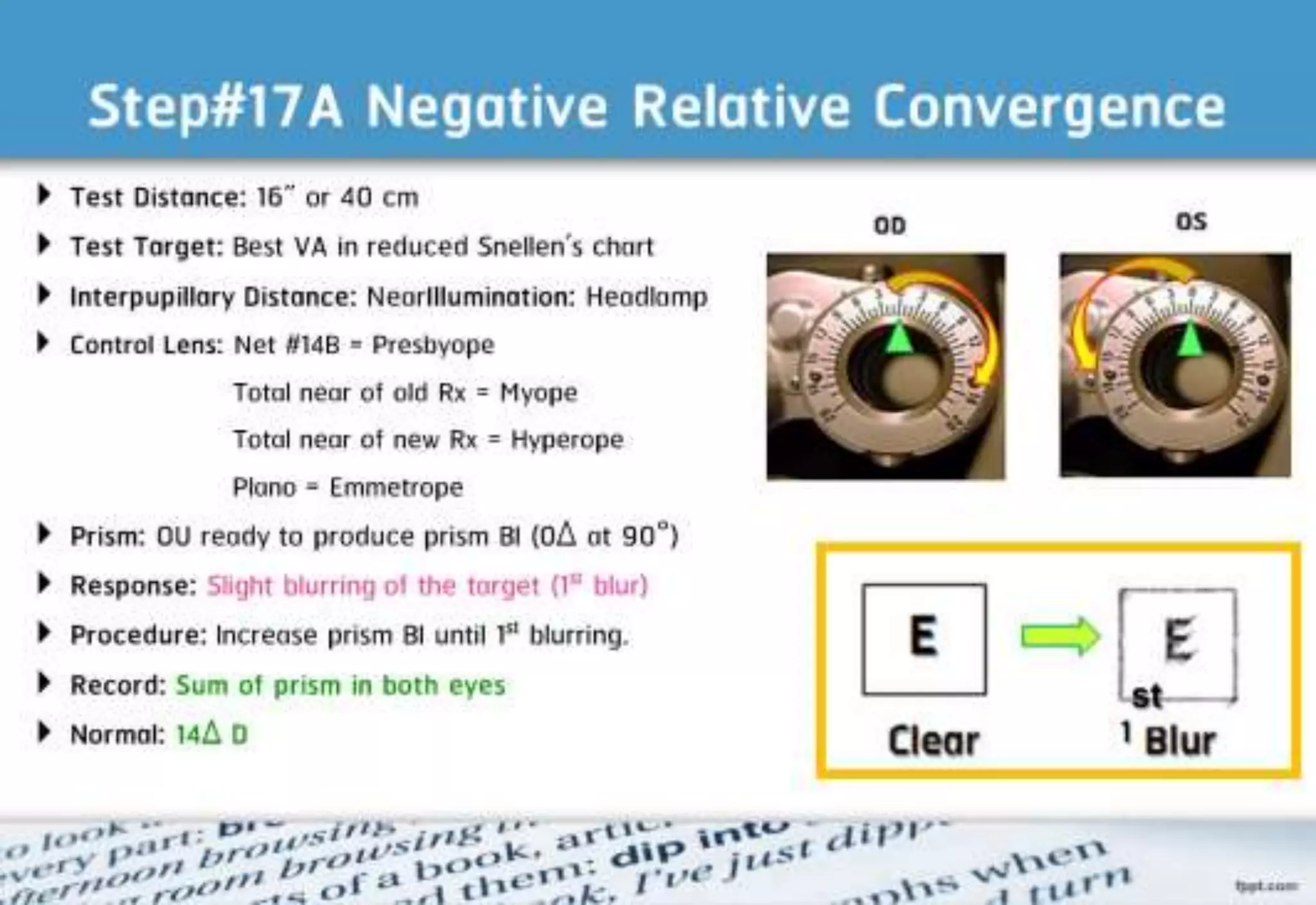 21 step-Diagnosis Procedure Refraction