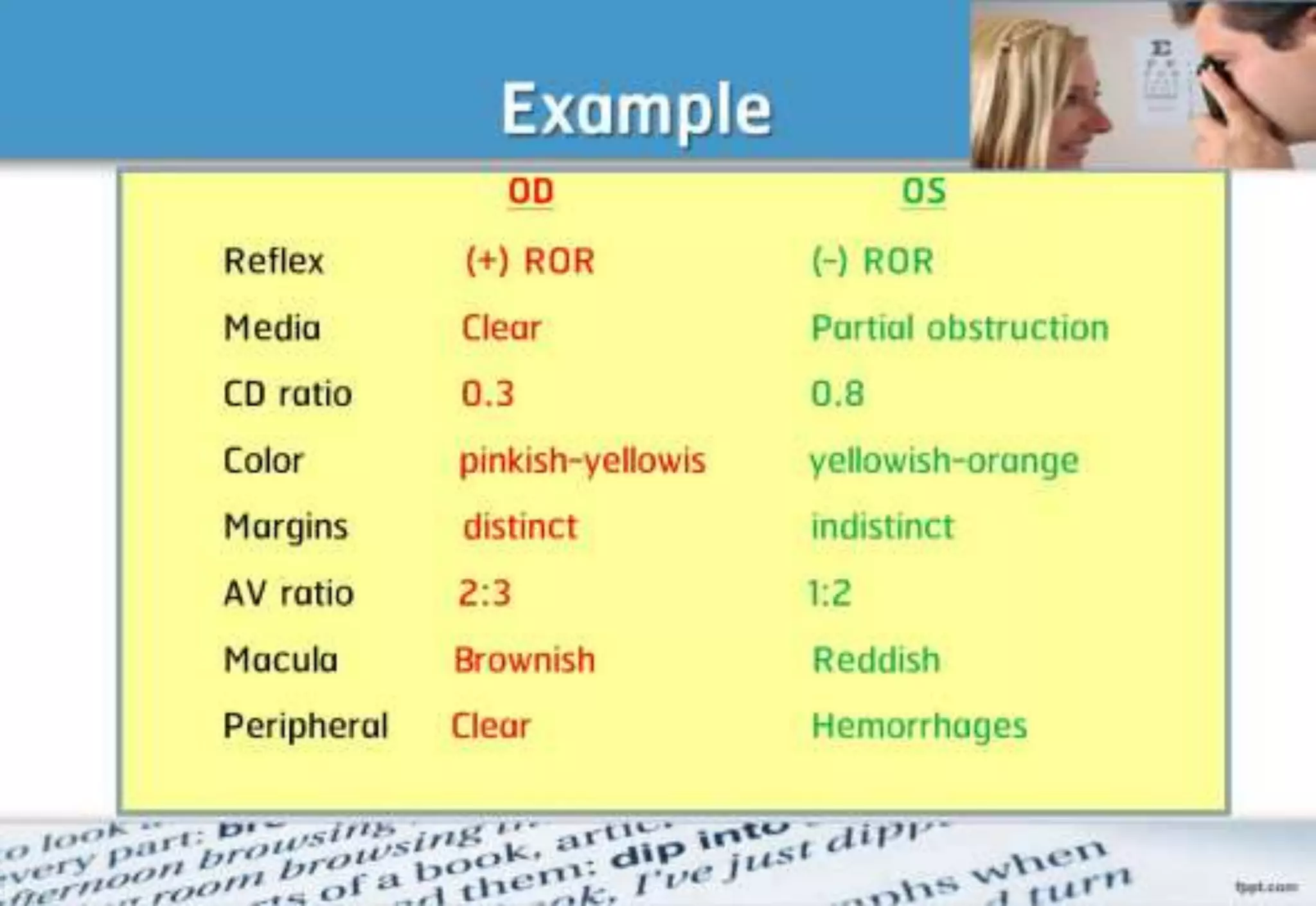 21 step-Diagnosis Procedure Refraction