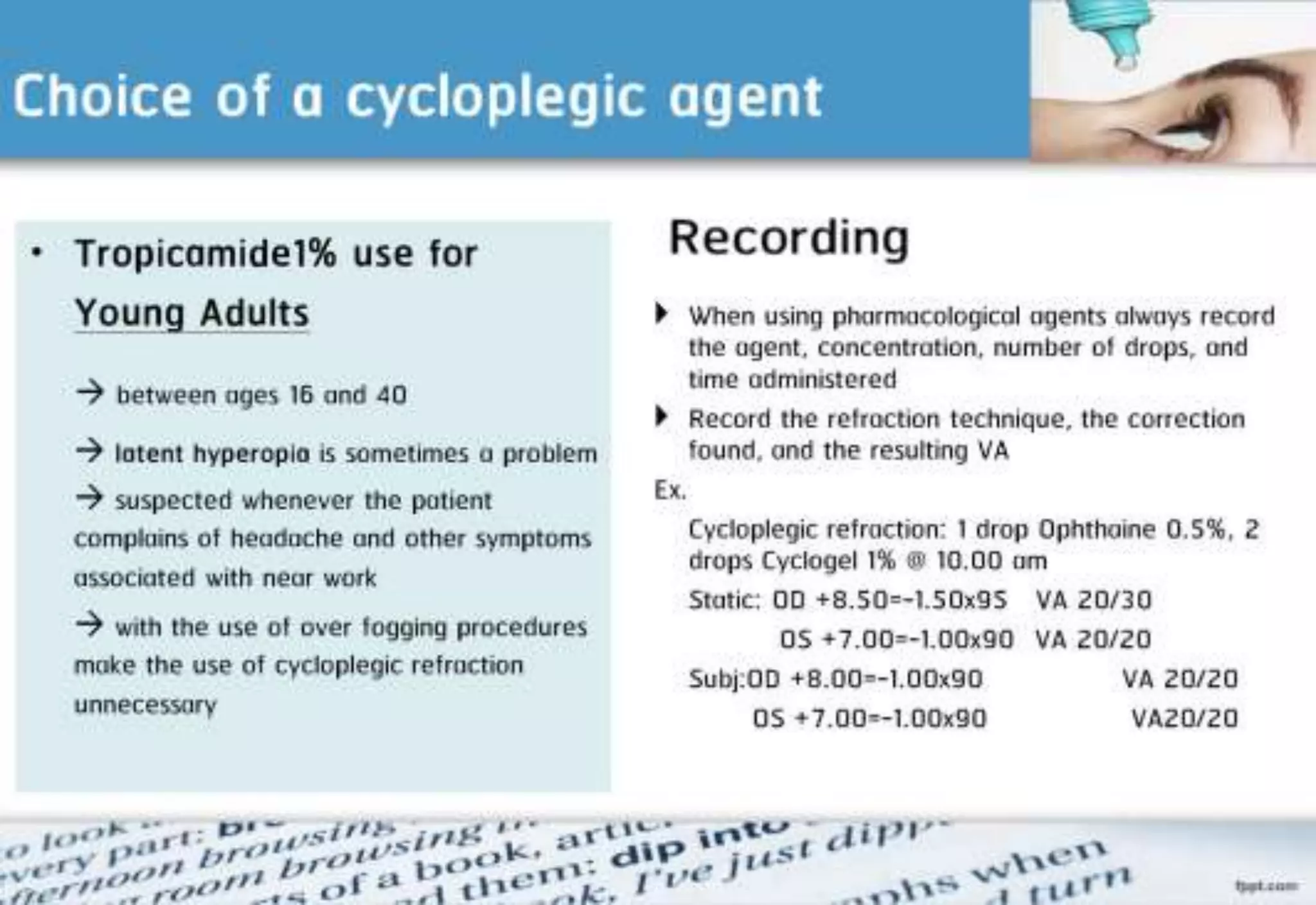 21 step-Diagnosis Procedure Refraction