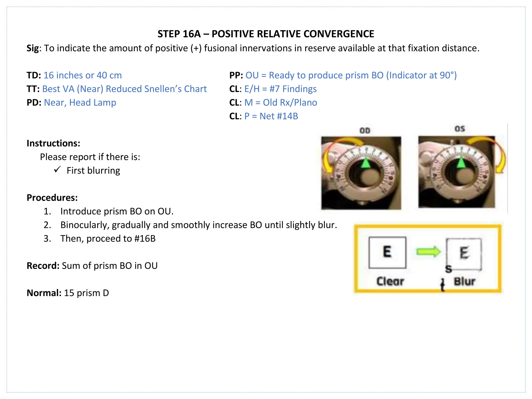 STEP 16A – POSITIVE RELATIVE CONVERGENCE
Sig: To indicate the amount of positive (+) fusional innervations in reserve available at that fixation distance.
TD: 16 inches or 40 cm PP: OU = Ready to produce prism BO (Indicator at 90°)
TT: Best VA (Near) Reduced Snellen’s Chart CL: E/H = #7 Findings
PD: Near, Head Lamp CL: M = Old Rx/Plano
CL: P = Net #14B
Instructions:
Please report if there is:
✓ First blurring
Procedures:
1. Introduce prism BO on OU.
2. Binocularly, gradually and smoothly increase BO until slightly blur.
3. Then, proceed to #16B
Record: Sum of prism BO in OU
Normal: 15 prism D
 