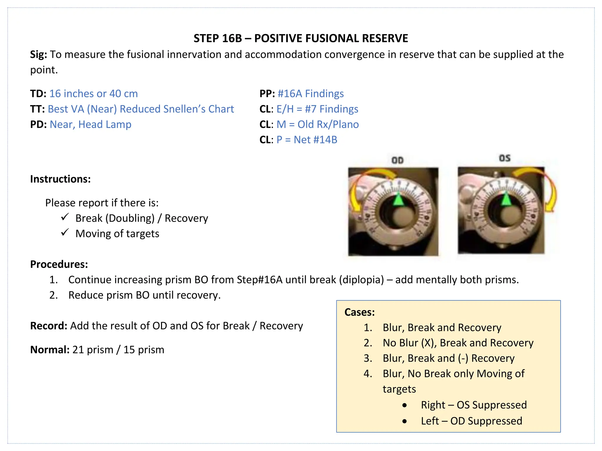 STEP 16B – POSITIVE FUSIONAL RESERVE
Sig: To measure the fusional innervation and accommodation convergence in reserve that can be supplied at the
point.
TD: 16 inches or 40 cm PP: #16A Findings
TT: Best VA (Near) Reduced Snellen’s Chart CL: E/H = #7 Findings
PD: Near, Head Lamp CL: M = Old Rx/Plano
CL: P = Net #14B
Instructions:
Please report if there is:
✓ Break (Doubling) / Recovery
✓ Moving of targets
Procedures:
1. Continue increasing prism BO from Step#16A until break (diplopia) – add mentally both prisms.
2. Reduce prism BO until recovery.
Record: Add the result of OD and OS for Break / Recovery
Normal: 21 prism / 15 prism
Cases:
1. Blur, Break and Recovery
2. No Blur (X), Break and Recovery
3. Blur, Break and (-) Recovery
4. Blur, No Break only Moving of
targets
• Right – OS Suppressed
• Left – OD Suppressed
 