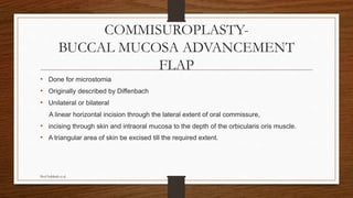 COMMISUROPLASTY-
BUCCAL MUCOSA ADVANCEMENT
FLAP
• Done for microstomia
• Originally described by Diffenbach
• Unilateral or bilateral
A linear horizontal incision through the lateral extent of oral commissure,
• incising through skin and intraoral mucosa to the depth of the orbicularis oris muscle.
• A triangular area of skin be excised till the required extent.
Prof Subbiah et al
 