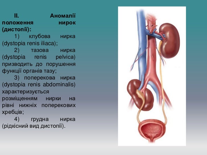 презент почка22
