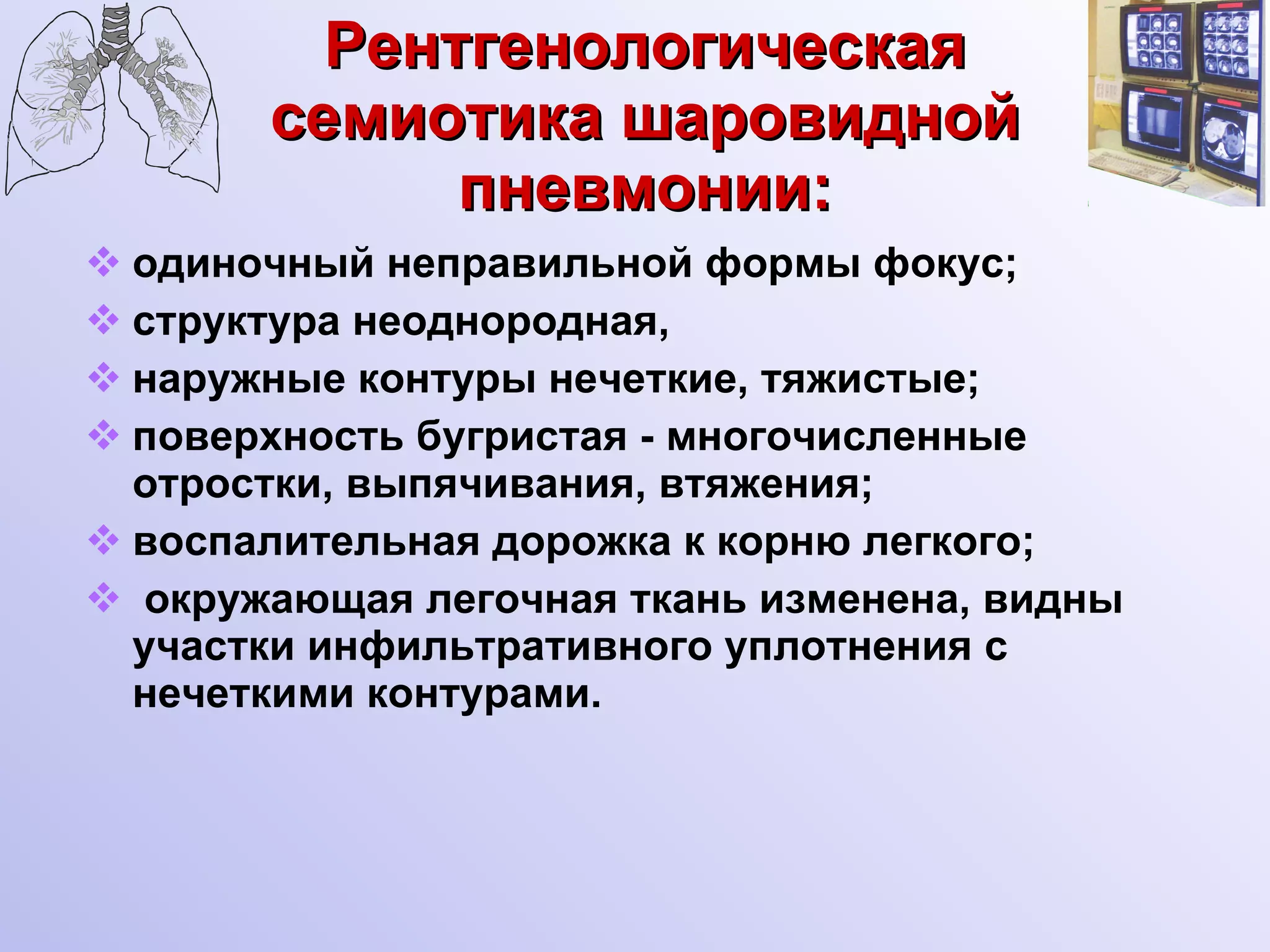 Рентгенологическая семиотика шаровидной пневмонии: одиночный неправильной формы фокус; структура   неоднородная,  наружные контуры нечеткие, тяжистые; поверхность бугристая - многочисленные отростки, выпячивания, втяжения;  воспалительная дорожка к корню легкого; окружающая легочная ткань изменена, видны участки инфильтративного уплотнения с нечеткими контурами. 