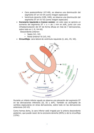 7
 Cara posteroinferior (V7-V8), se observa una disminución del
segmento ST en V3-V4 (como imagen especular)
 Ventrículo derecho (V3R, V4R), se observa una disminución del
segmento ST en V1-V2 (como imagen especular)
 Coronaria izquierda o tronco común: en este caso se aprecia un
aumento del segmento ST > o = de 1 mm en aVR, junto con una
infradesnivelación del ST de forma difusa en más de 7 derivaciones,
sobre todo en I, II, V4-V6)
Descendente anterior:
 Septo (V1, V2)
 Pared anterior VI (V3, V4)
 Circunfleja: cara lateral de ventrículo izquierdo (I, aVL, V5, V6).
Durante un infarto inferior agudo se observa una elevación del segmento ST
en las derivaciones inferiores (II, III y aVF). También se acompaña de
cambios especulares en otras derivaciones, sobre todo en las derivaciones
anteriores (V2-V3)
Como hemos dicho, la cara inferior está irrigada por la arteria descendente
posterior, que puede nacer de la coronaria derecha (85%) o de la circunfleja
(15%).
 
