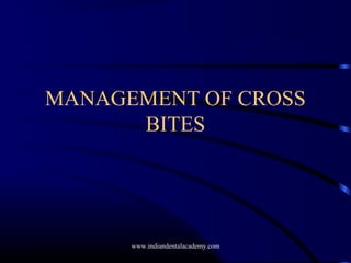 MANAGEMENT OF CROSS
BITES
www.indiandentalacademy.com
 