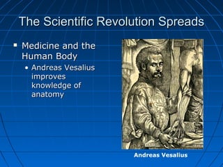The Scientific Revolution SpreadsThe Scientific Revolution Spreads
 Medicine and theMedicine and the
Human BodyHuman Body
• Andreas VesaliusAndreas Vesalius
improvesimproves
knowledge ofknowledge of
anatomyanatomy
Andreas Vesalius
 