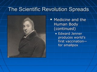 The Scientific Revolution SpreadsThe Scientific Revolution Spreads
 Medicine and theMedicine and the
Human BodyHuman Body
(continued)(continued)
• Edward JennerEdward Jenner
produces world’sproduces world’s
first vaccination—first vaccination—
for smallpoxfor smallpox
 
