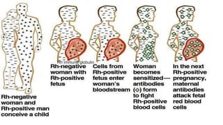Rh immune globulin
 