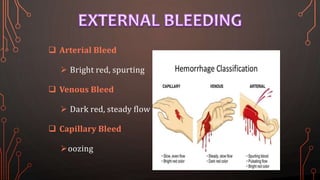  Arterial Bleed
 Bright red, spurting
 Venous Bleed
 Dark red, steady flow
 Capillary Bleed
oozing
 