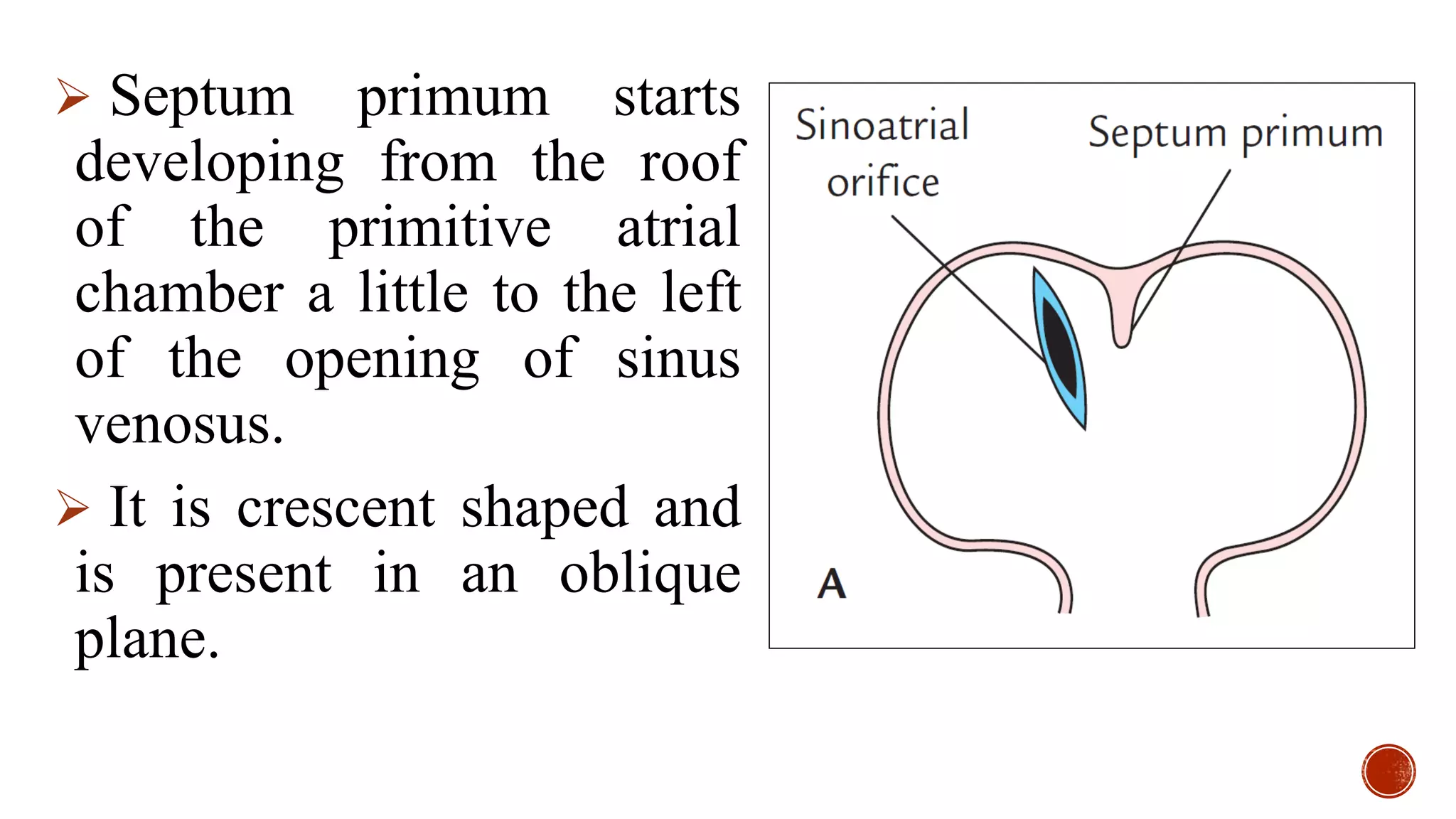 22. Development of Interatrial and Interventricular septum 2020.pdf