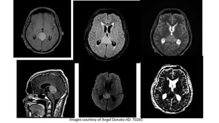 Images courtesy of Angel Donato rID: 70265
 