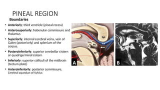 PINEAL REGION
Boundaries
• Anteriorly: third ventricle (pineal recess)
• Anterosuperiorly: habenular commissure and
thalamus
• Superiorly: internal cerebral veins, vein of
Galen (posteriorly) and splenium of the
corpus.
• Posteroinferiorly: superior cerebellar cistern
or quadrigerminal cistern
• Inferiorly: superior colliculi of the midbrain
(tectum plate)
• Anteroinferiorly: posterior commissure,
Cerebral aqueduct of Sylvius
 