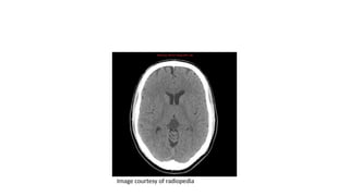 Image courtesy of radiopedia
 