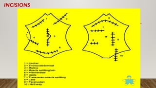 Comprehensive Overview of Acute Abdomen: Signs, Pain Types, and ...
