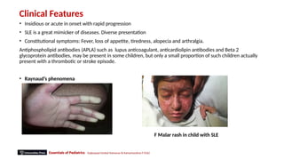 Juvenile idiopathic arthritis and systemic lupus erythematosus | PPTX