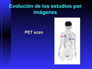 PET scan Evolución de los estudios por imágenes 